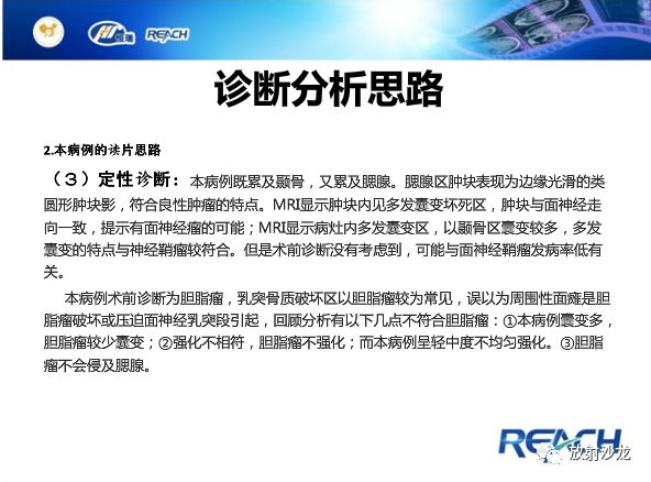 【病例】面神经鞘瘤1例CT及MR影像表现