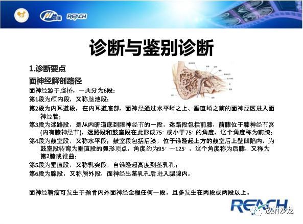【病例】面神经鞘瘤1例CT及MR影像表现