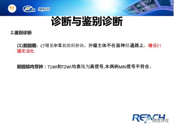 【病例】面神经鞘瘤1例CT及MR影像表现
