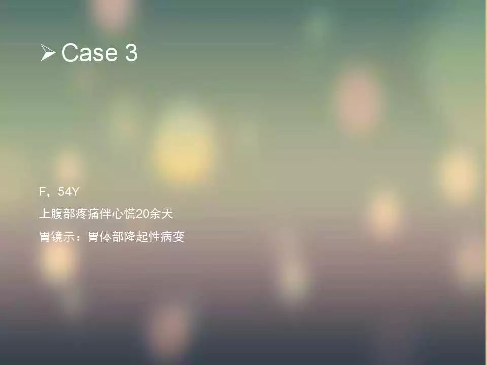 【PPT】(3例)胃部病变病例分析