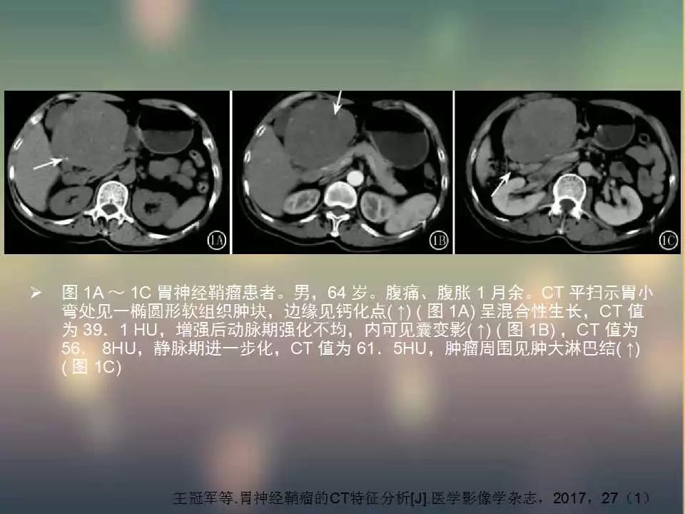 【PPT】(3例)胃部病变病例分析