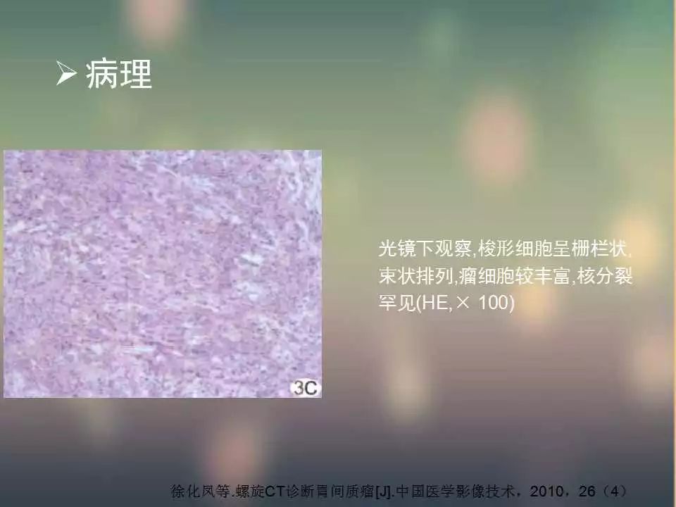 【PPT】(3例)胃部病变病例分析