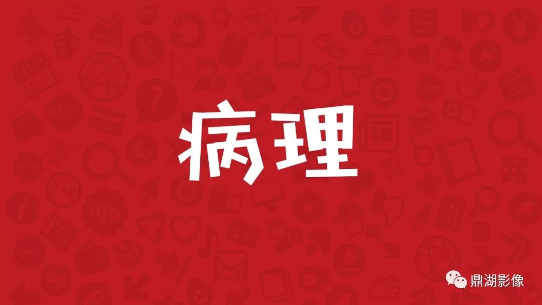 【PPT】颅内脂肪瘤影像诊断及鉴别诊断