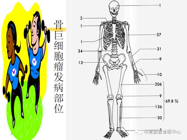 【PPT】骨巨细胞瘤的影像诊断及鉴别诊断