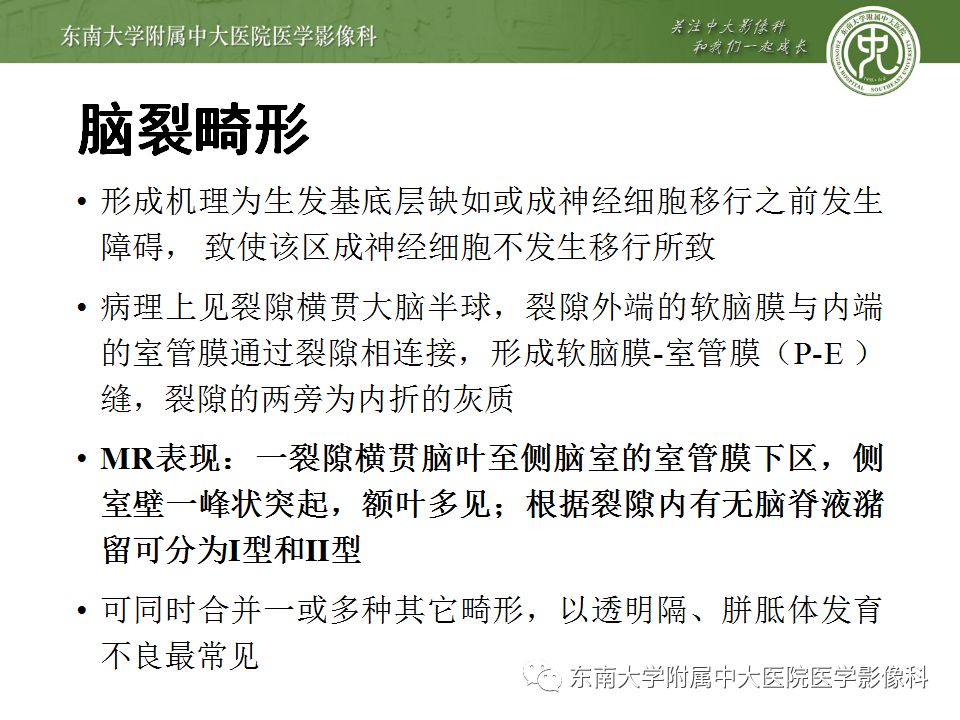 【病例】分离型脑裂畸形、脑灰质异位、透明隔缺如、胼胝体发育不良1例MR