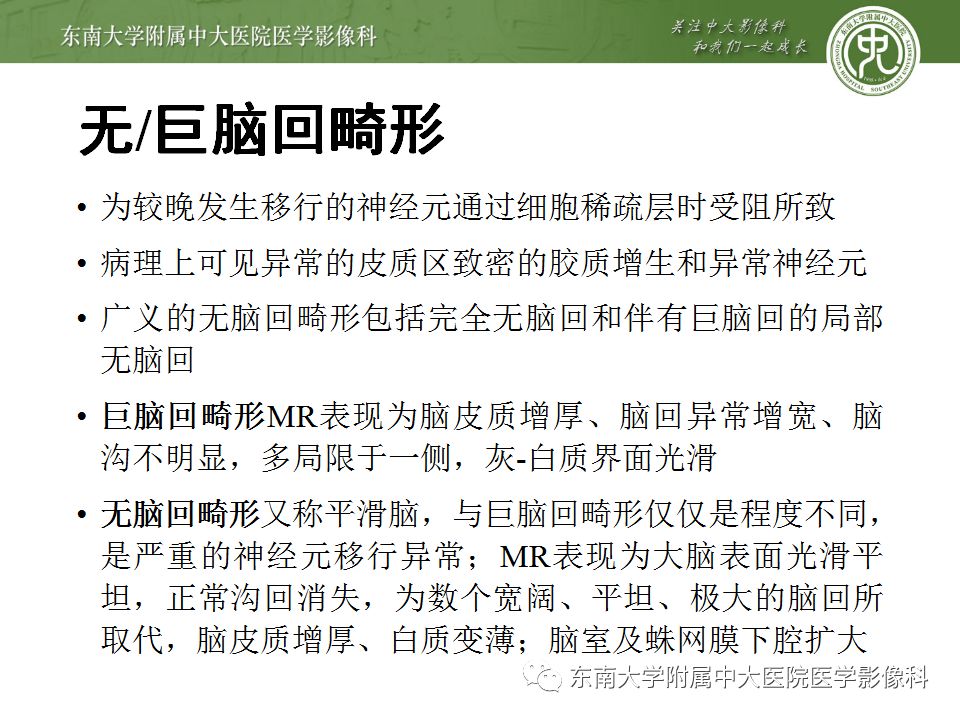 【病例】分离型脑裂畸形、脑灰质异位、透明隔缺如、胼胝体发育不良1例MR