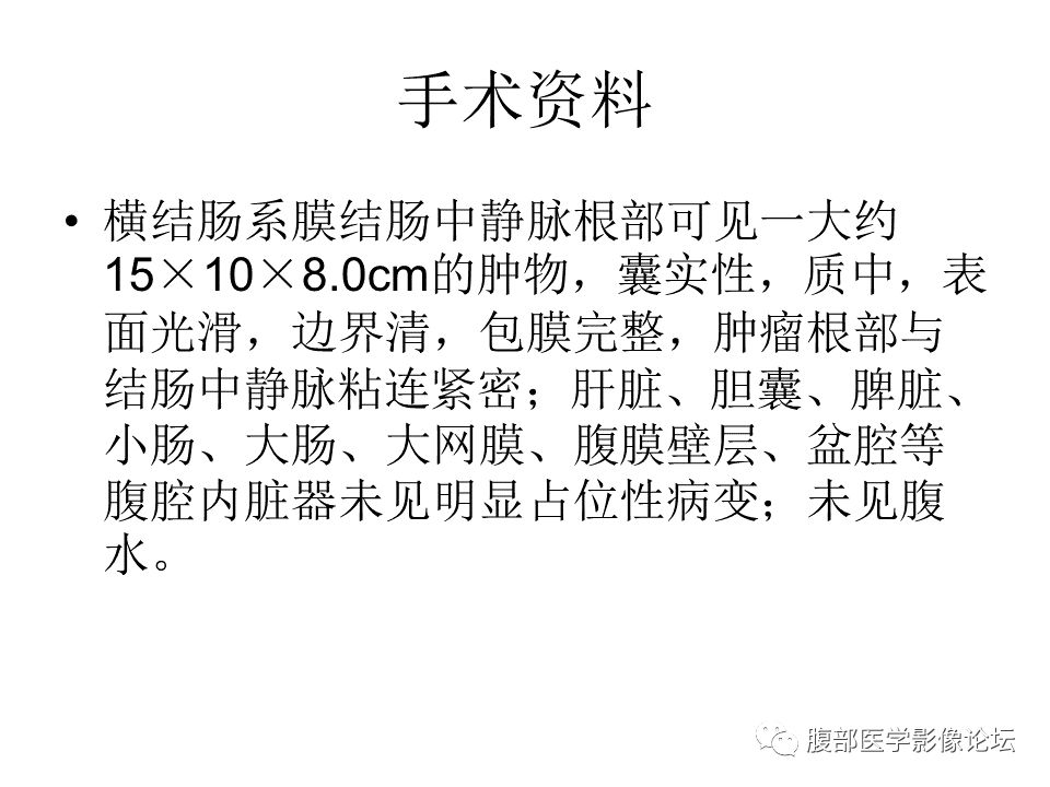 【病例】腹腔副神经节瘤1例CT