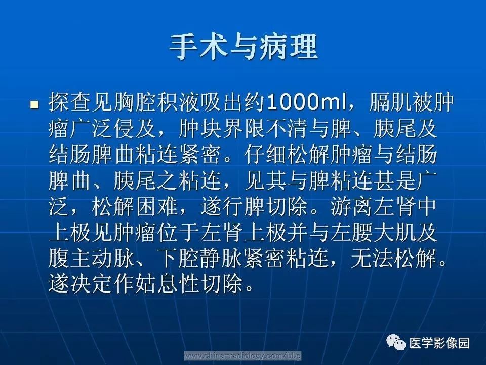 【病例】脾脏血管肉瘤1例CT影像表现