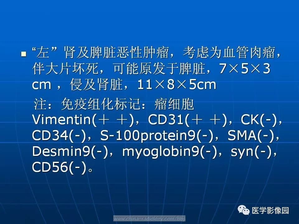 【病例】脾脏血管肉瘤1例CT影像表现