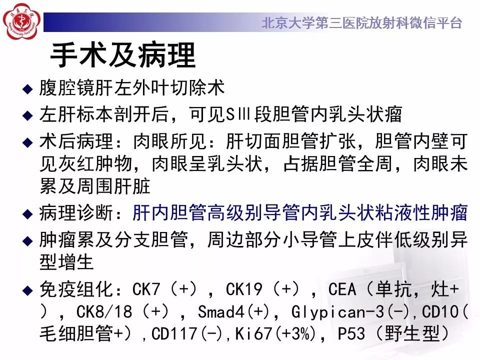 【病例】胆管导管内乳头状肿瘤1例CT及MR影像表现
