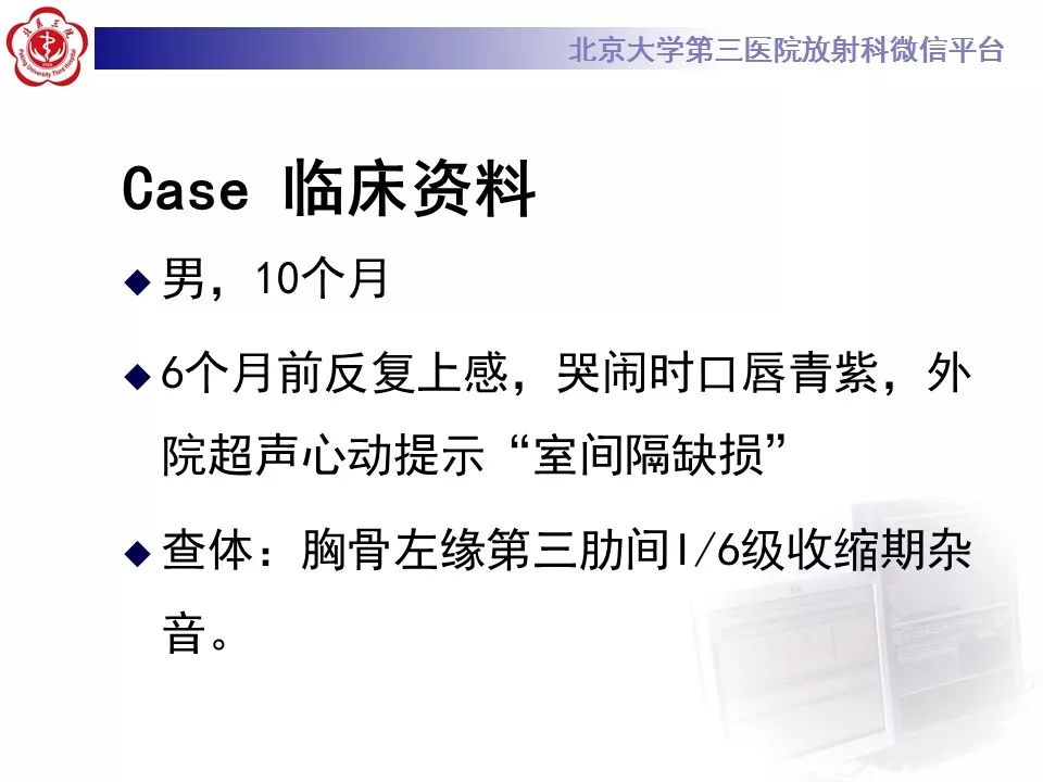【病例】先天性心脏病—右室双出口1例CT