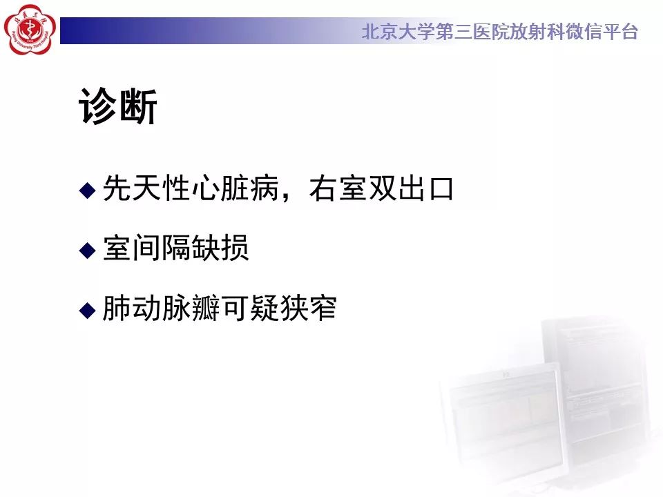 【病例】先天性心脏病—右室双出口1例CT