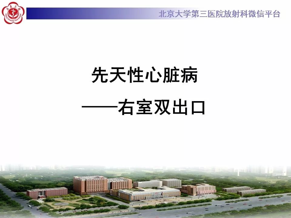 【病例】先天性心脏病—右室双出口1例CT
