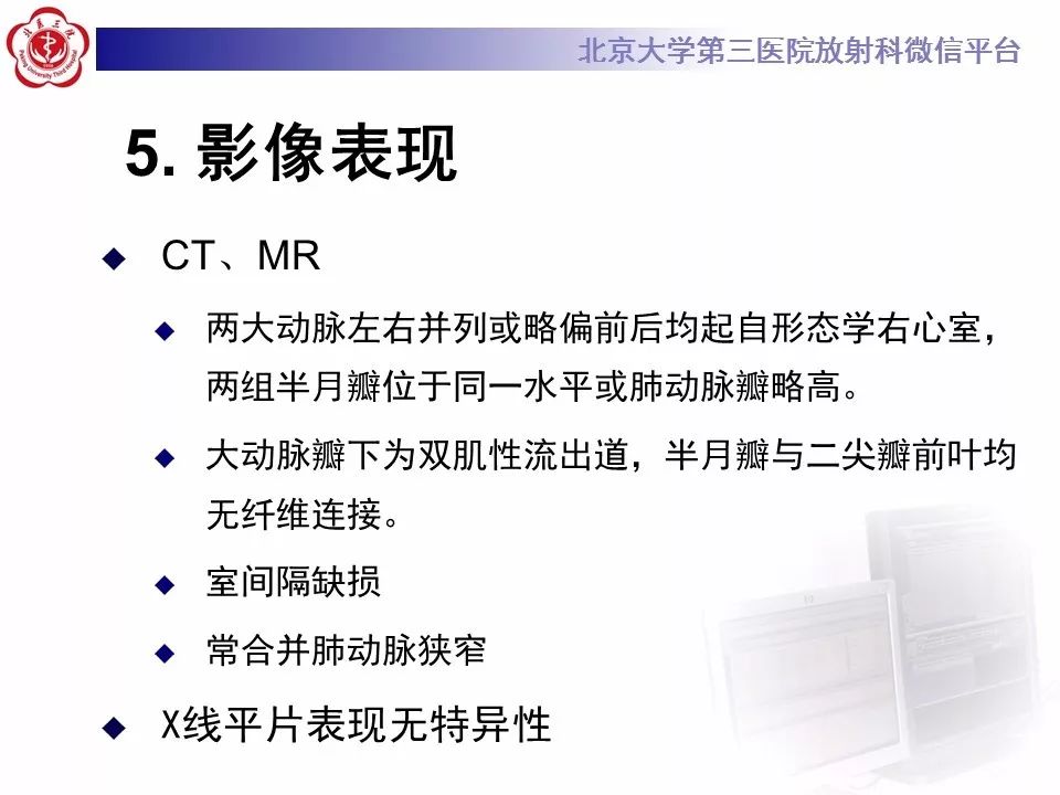 【病例】先天性心脏病—右室双出口1例CT