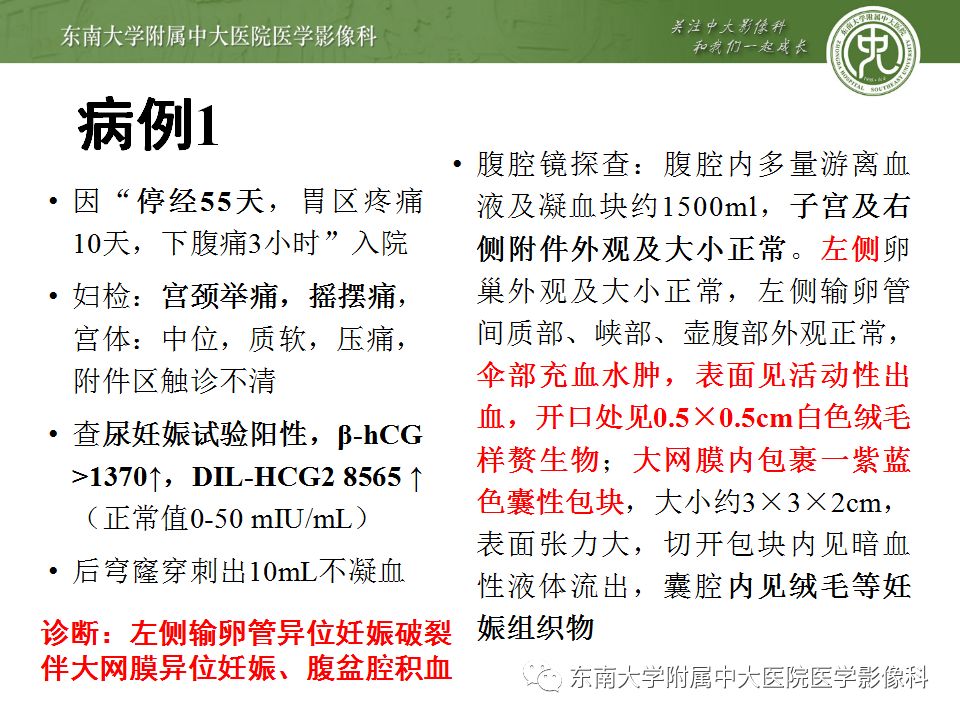 【病例】妇科急腹症3例随访读片