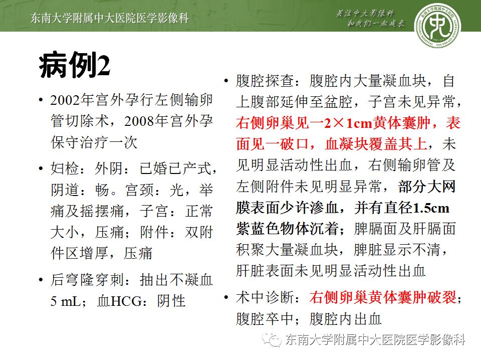【病例】妇科急腹症3例随访读片