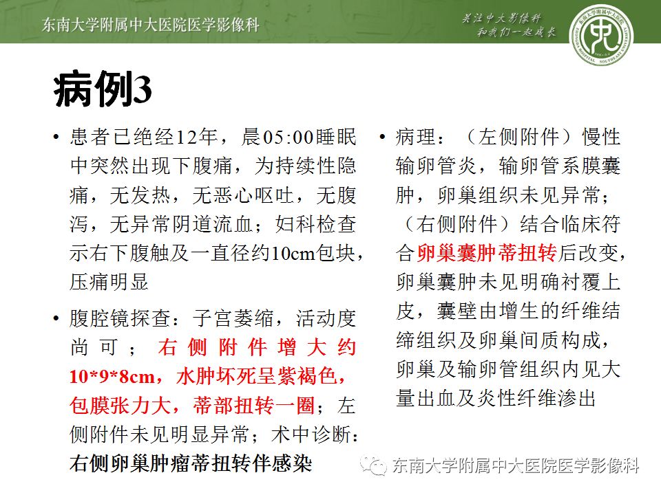 【病例】妇科急腹症3例随访读片