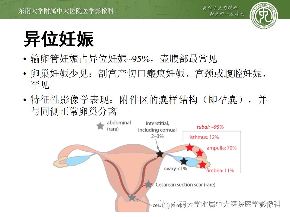 【病例】妇科急腹症3例随访读片