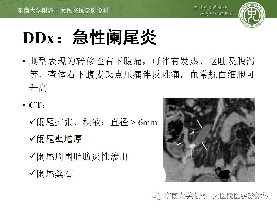 【病例】妇科急腹症3例随访读片