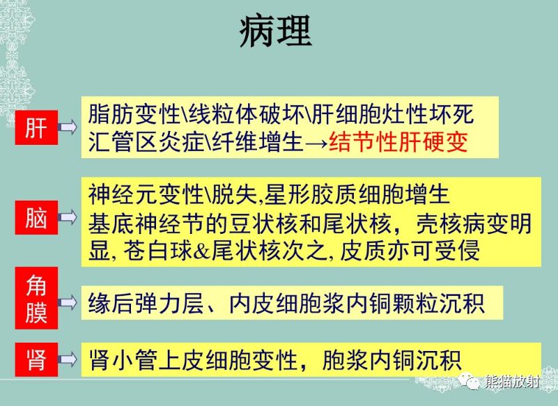 肝豆状核变性(Wilson病) 肝豆状核变性(Wilson病)