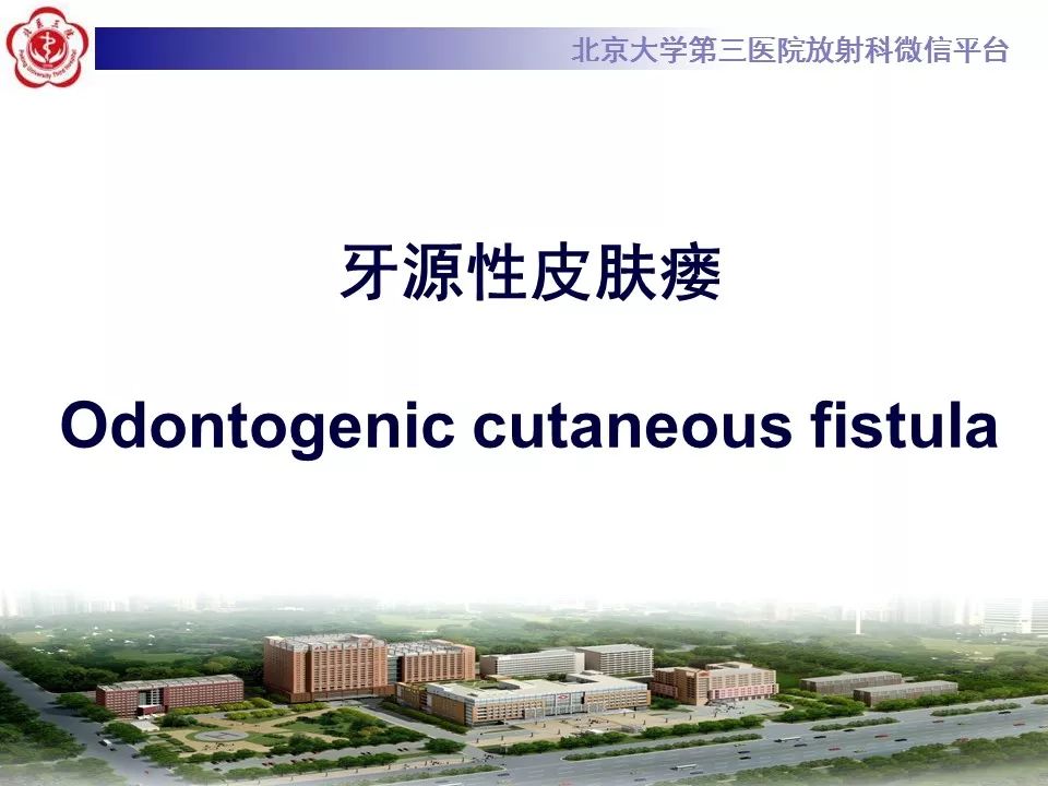 【病例】牙源性皮肤瘘1例CT及MR影像表现