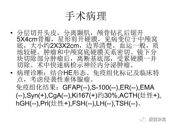 【病例】左颞部异位垂体瘤1例CT及MR