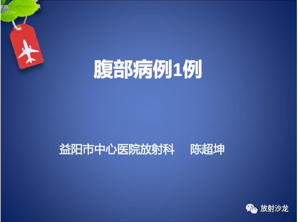 【病例】Budd-Chiari布加综合征1例CT影像表现