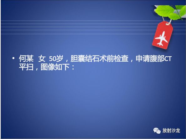 【病例】Budd-Chiari布加综合征1例CT影像表现