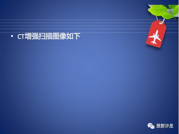 【病例】Budd-Chiari布加综合征1例CT影像表现