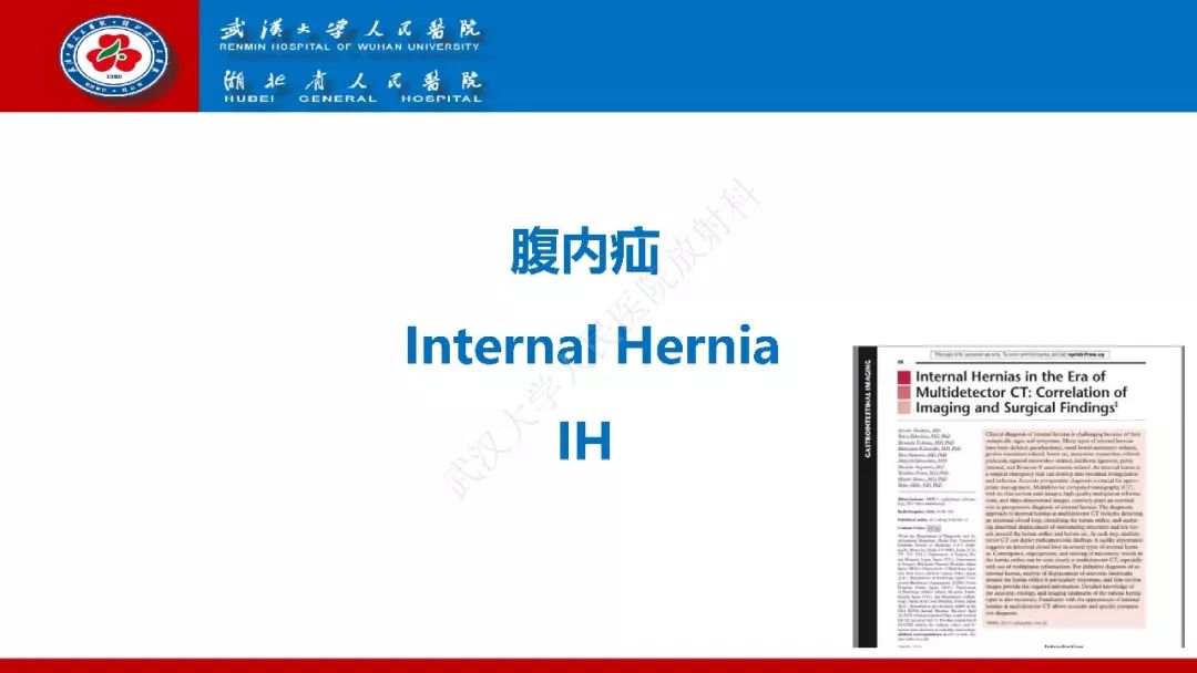 【PPT】腹内疝影像诊断