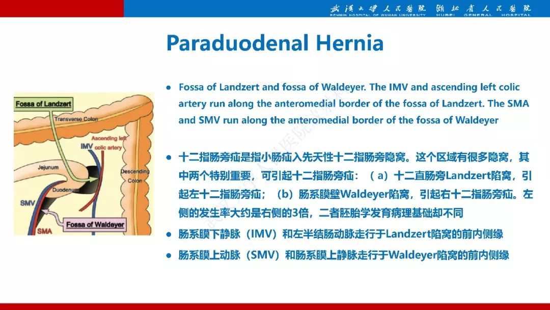 【PPT】腹内疝影像诊断