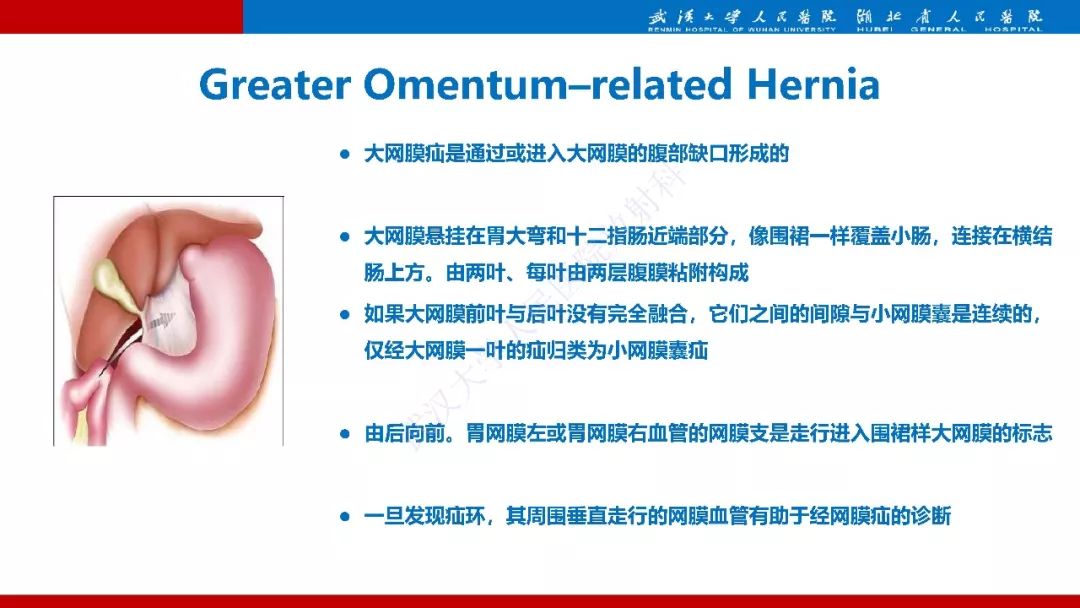 【PPT】腹内疝影像诊断