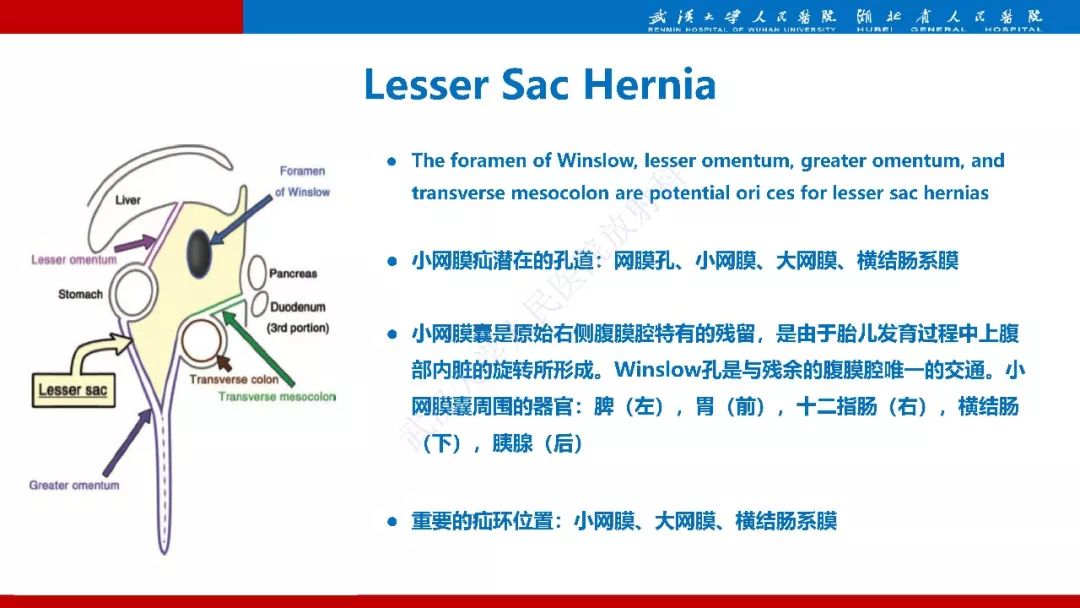 【PPT】腹内疝影像诊断