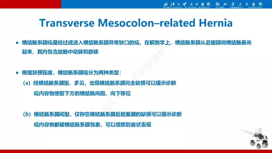 【PPT】腹内疝影像诊断