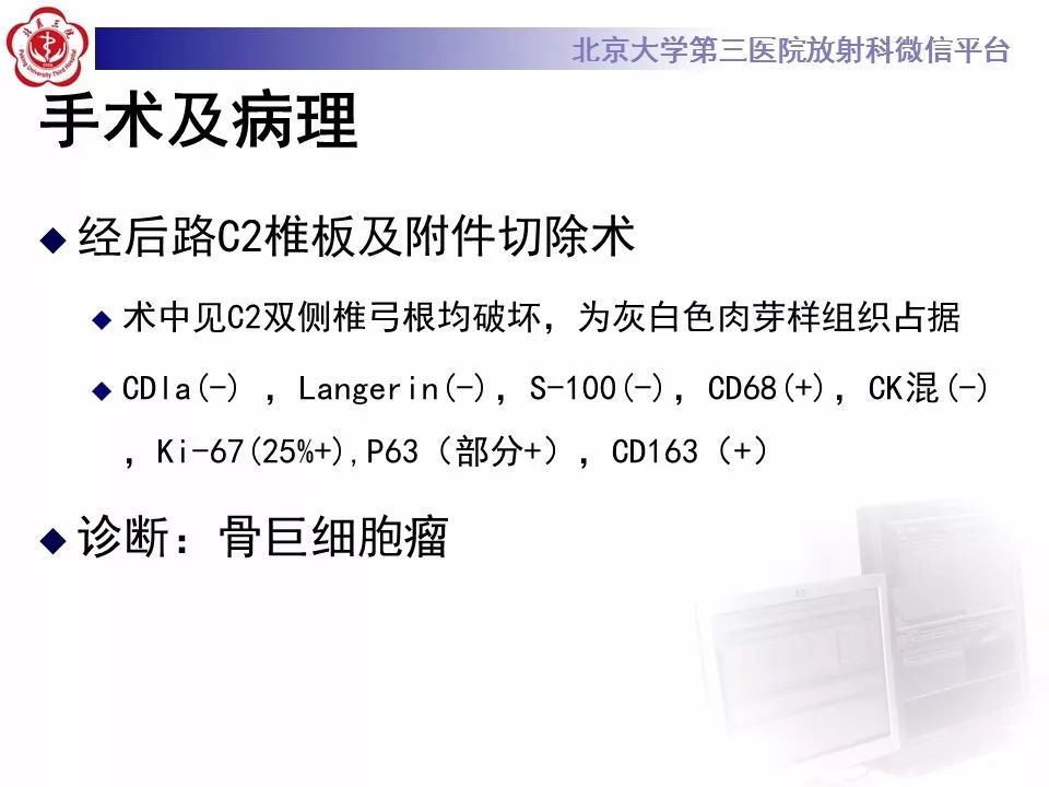 【病例】颈椎骨巨细胞瘤1例CT及MR影像诊断