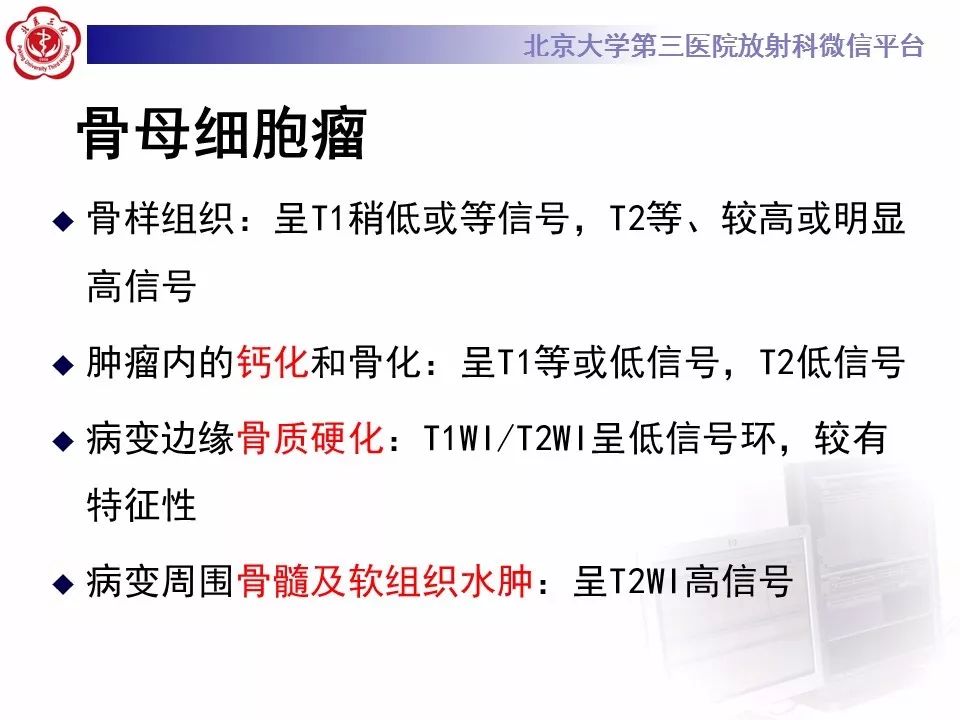 【病例】颈椎骨巨细胞瘤1例CT及MR影像诊断