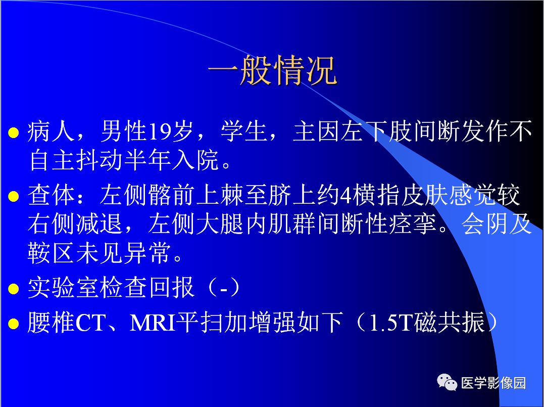 【病例】椎管内表皮样囊肿1例CT及MR