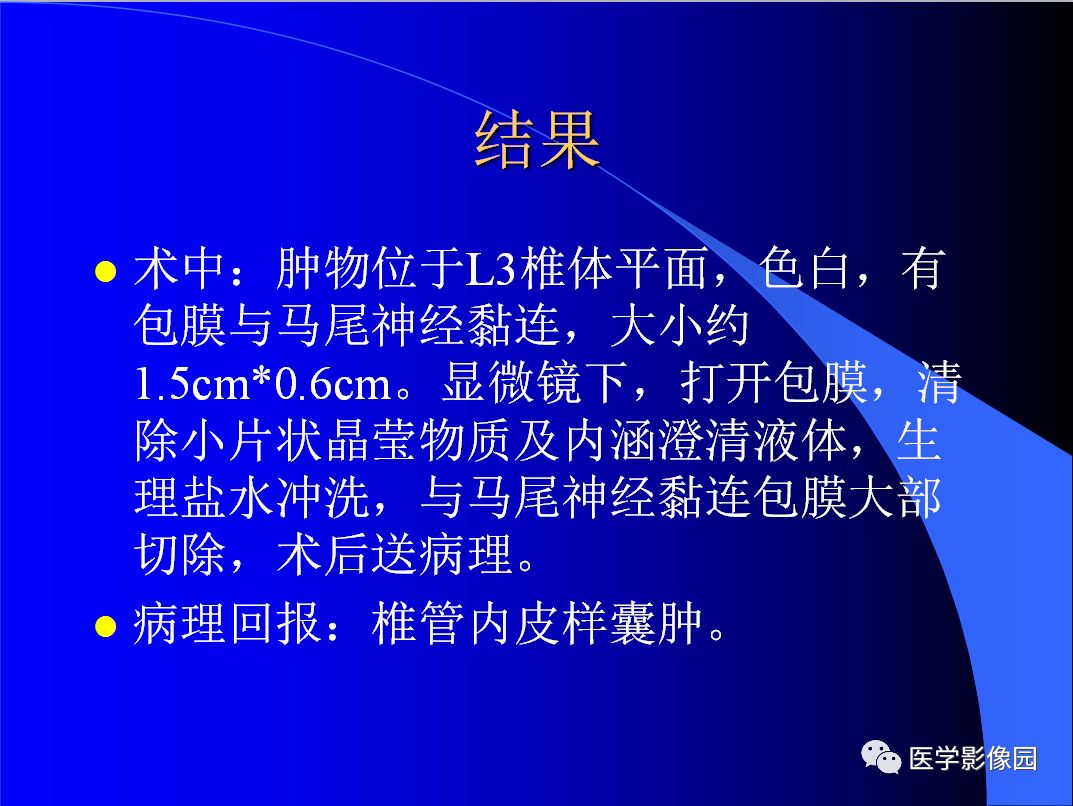 【病例】椎管内表皮样囊肿1例CT及MR