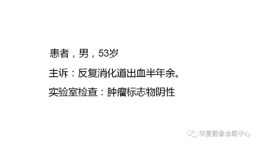 【病例】回肠异位胰腺1例CT影像表现