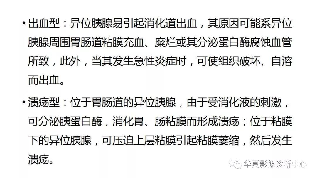 【病例】回肠异位胰腺1例CT影像表现