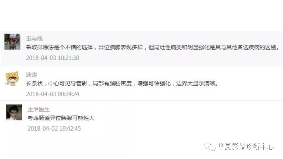【病例】回肠异位胰腺1例CT影像表现