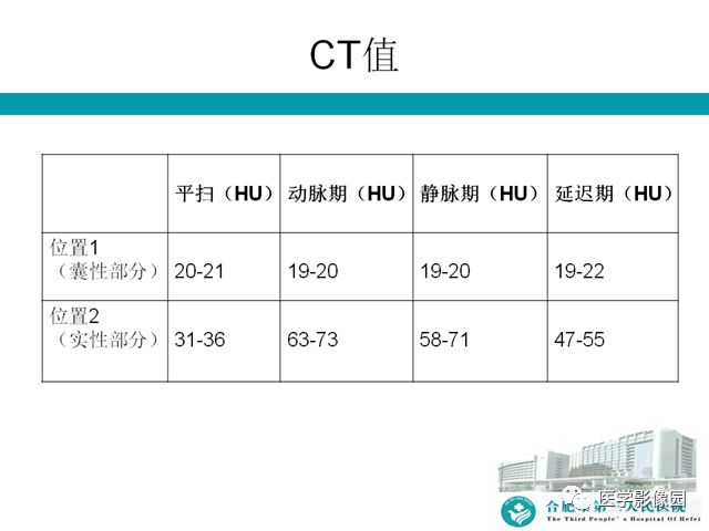 【病例】小肠系膜间质瘤1例CT 【病例】小肠系膜间质瘤1例CT