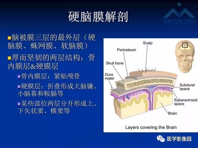【PPT】脑膜瘤以外的硬脑膜肿块：影像学表现与鉴别诊断