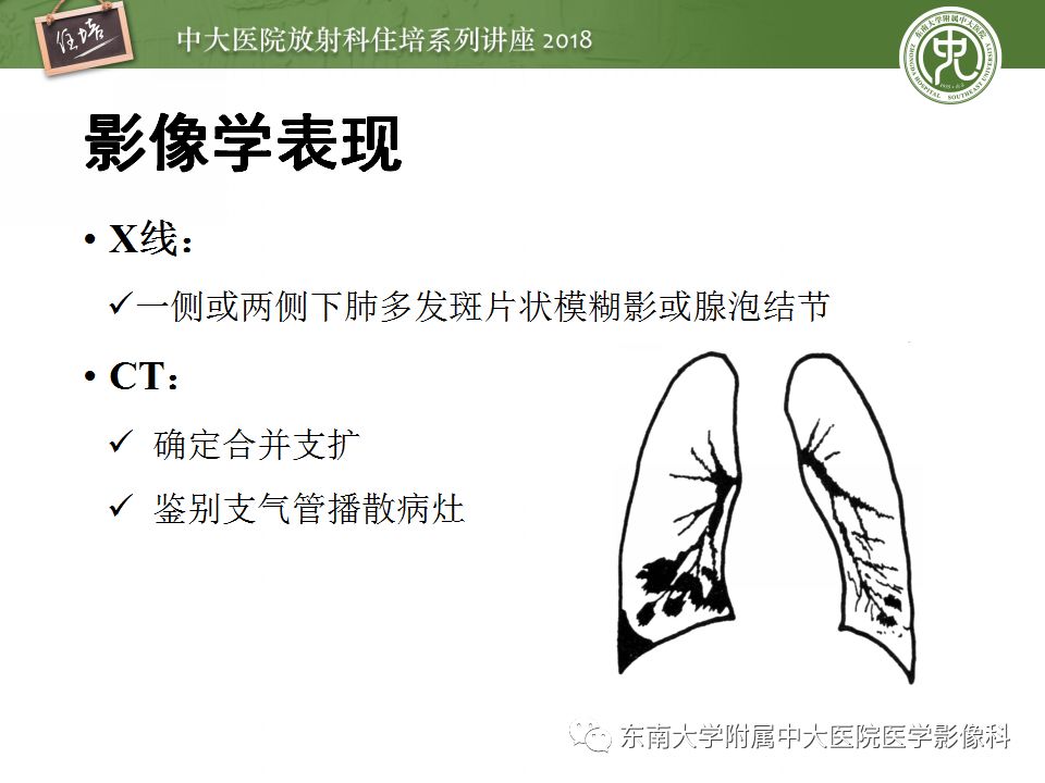 【PPT】肺部感染性疾病影像诊断及鉴别（一）