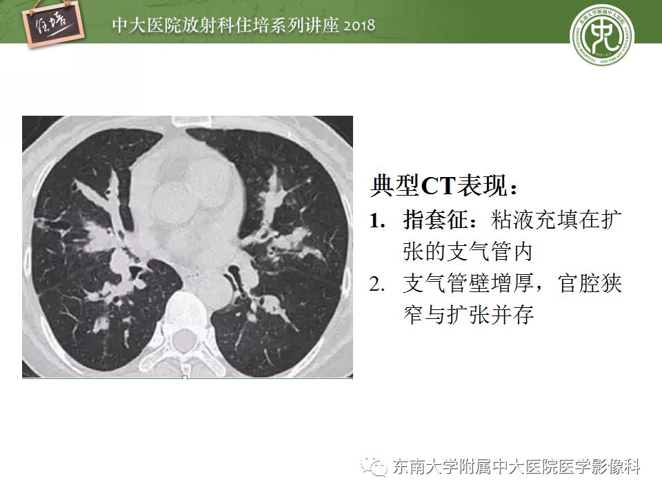 【PPT】肺部感染性疾病影像诊断及鉴别（一）
