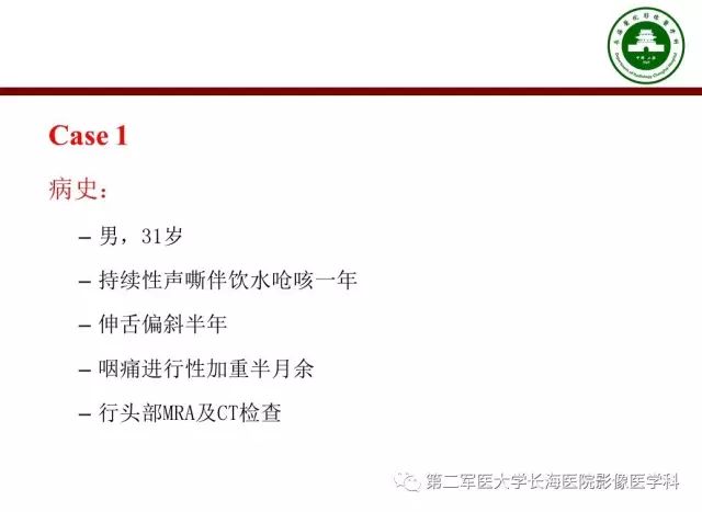 【PPT】颈静脉孔区常见病变的诊断与鉴别诊断