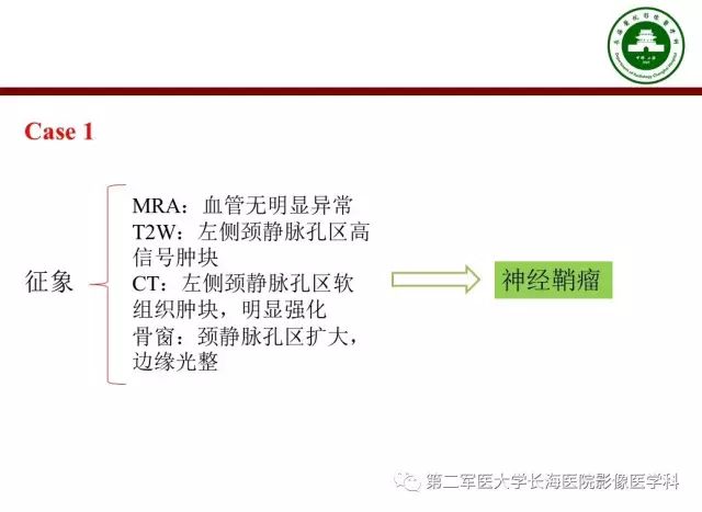 【PPT】颈静脉孔区常见病变的诊断与鉴别诊断