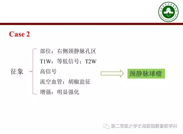 【PPT】颈静脉孔区常见病变的诊断与鉴别诊断