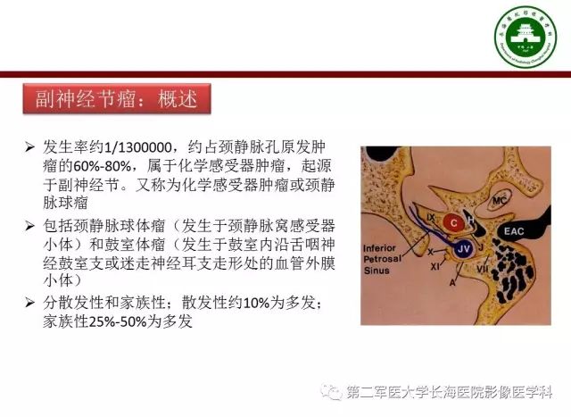 【PPT】颈静脉孔区常见病变的诊断与鉴别诊断