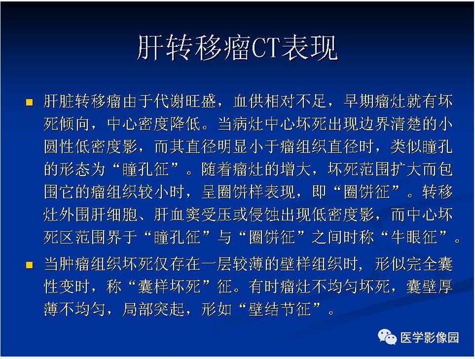 【PPT】肝脏转移瘤的影像学诊断